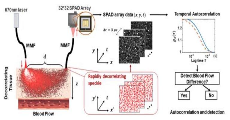 Fast and Sensitive Diffuse Correlation Spectroscopy with Highly Parallelized Single Photon Detection